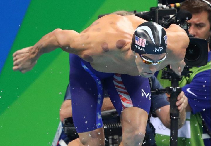 Cupping: Understanding Phelps And His Purple Bruises - Swimming World News